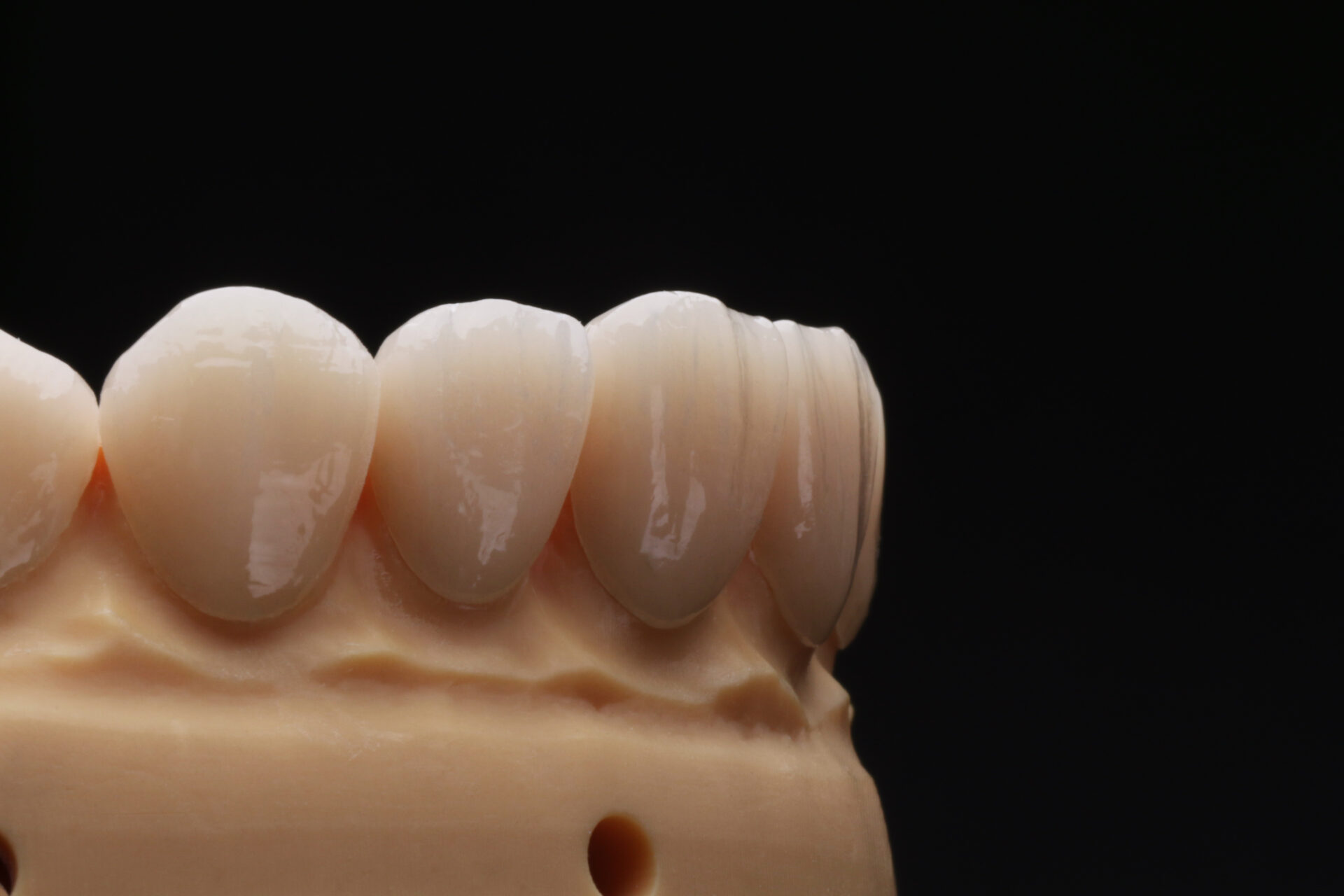Disilicato Glass Ceramic 18X15X13 POR 5 - Imagen 4